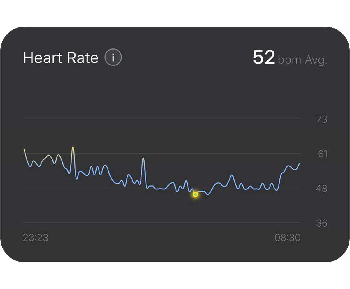 Resting Heart Rate